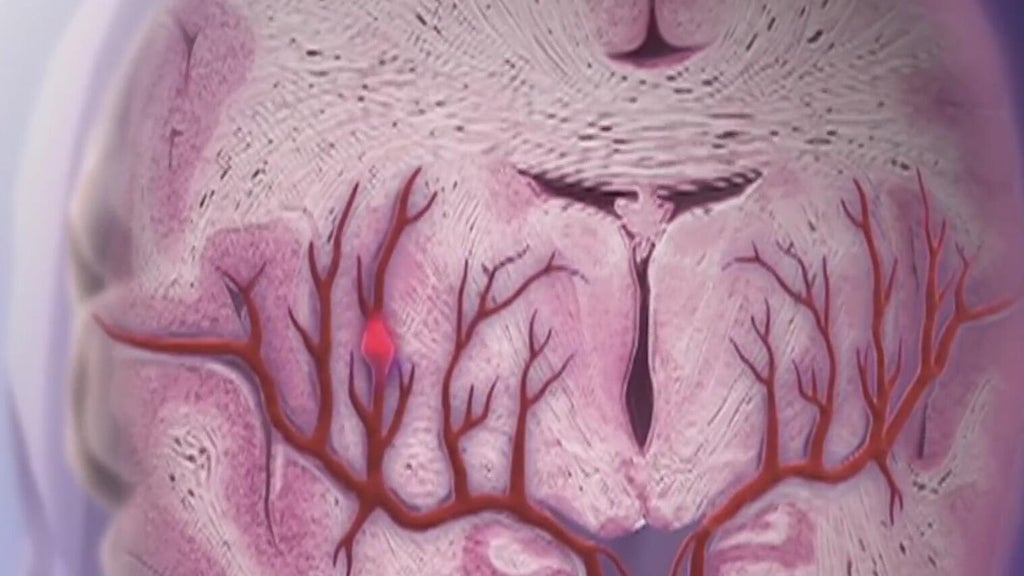 Knowing the signs of a stroke can save lives — Stockbridge Community news